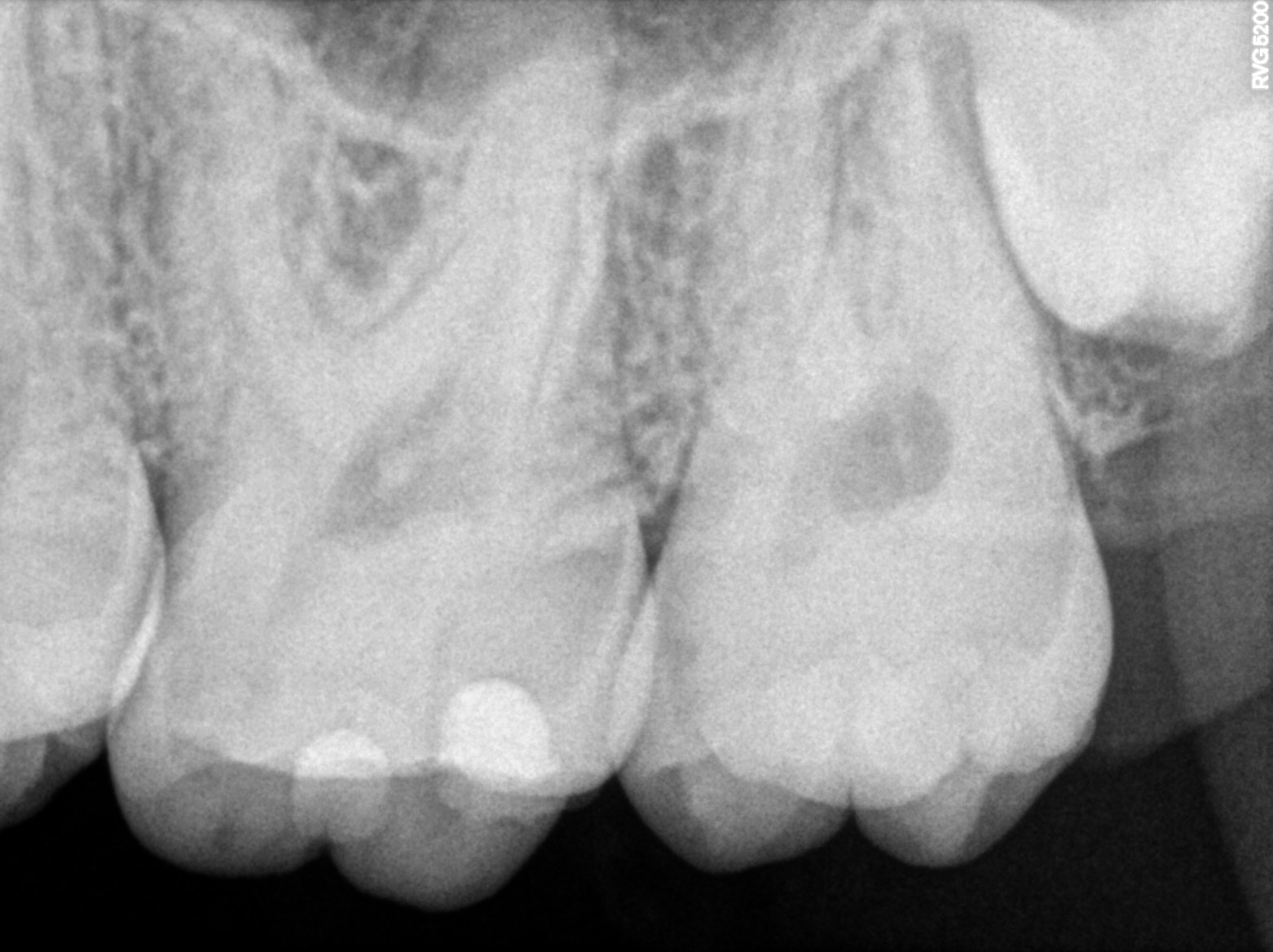 Dental X-ray